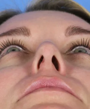 Close-up of a person's face looking upward, focusing on the nose and eyes against a blue sky background.