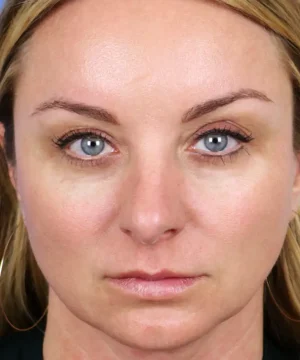 Close-up of a person with blue eyes and blonde hair, looking directly at the camera with a neutral expression.