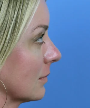 Profile view of a person with blonde hair against a blue background.