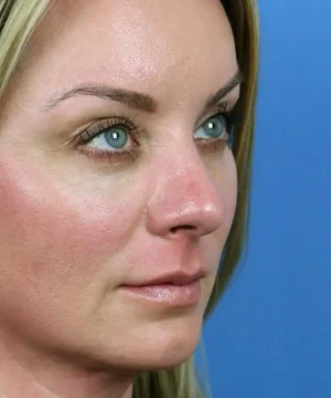 A woman with blonde hair gazes slightly upwards against a blue background.