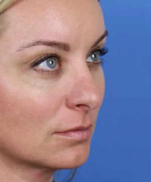 Profile view of a person with light skin and blue eyes, looking to the right against a blue background.