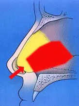 Diagram of a nasal cavity side view with a red arrow pointing to the yellow-highlighted area inside the nose.