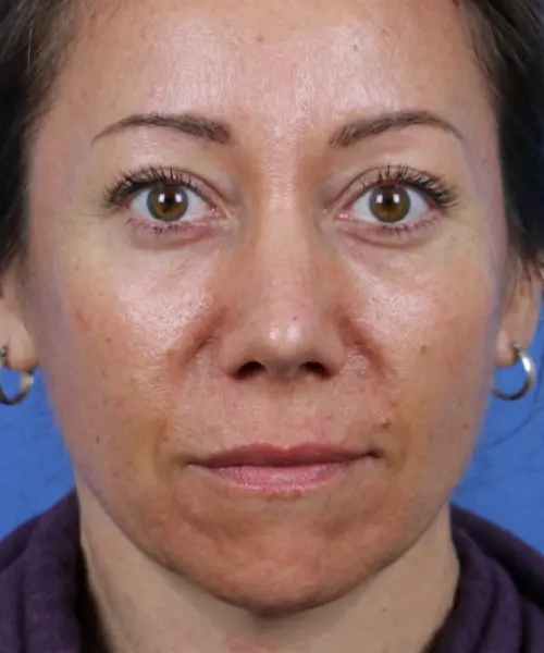 A woman with a neutral expression looks directly at the camera against a blue background. She has brown eyes and is wearing hoop earrings.