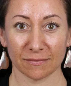 A person with long earrings and a neutral expression, looking directly at the camera.