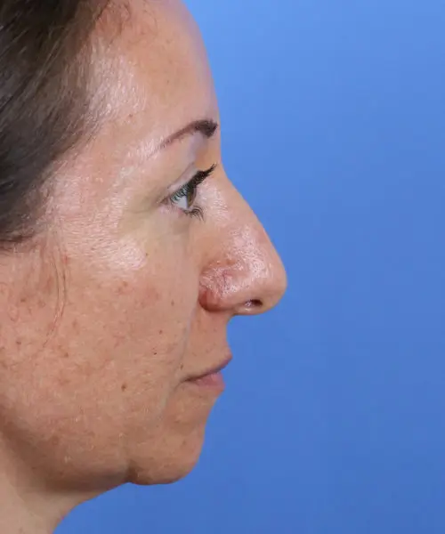 Profile view of a person with dark hair against a blue background.