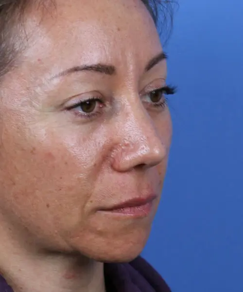 A person with a neutral expression is shown in close-up against a blue background.