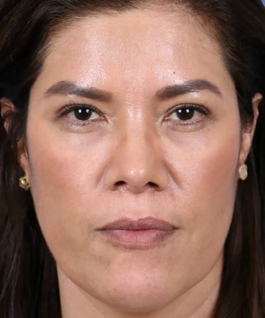 Portrait of a person with long dark hair, wearing small earrings, looking directly at the camera with a neutral expression.