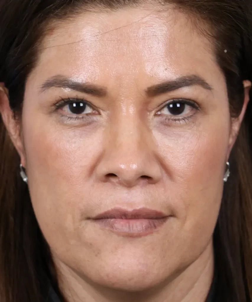 A woman with brown hair and a neutral expression looks directly at the camera. She is wearing stud earrings.