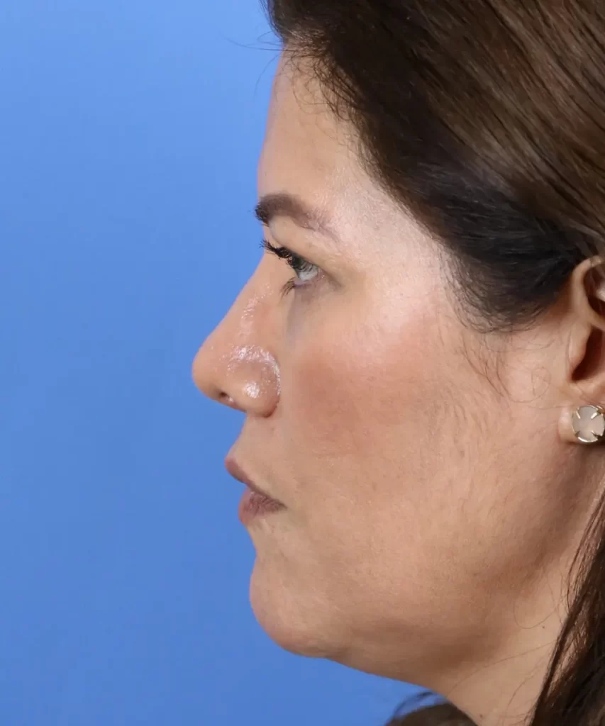 Profile view of a person with brown hair against a blue background, wearing earrings.
