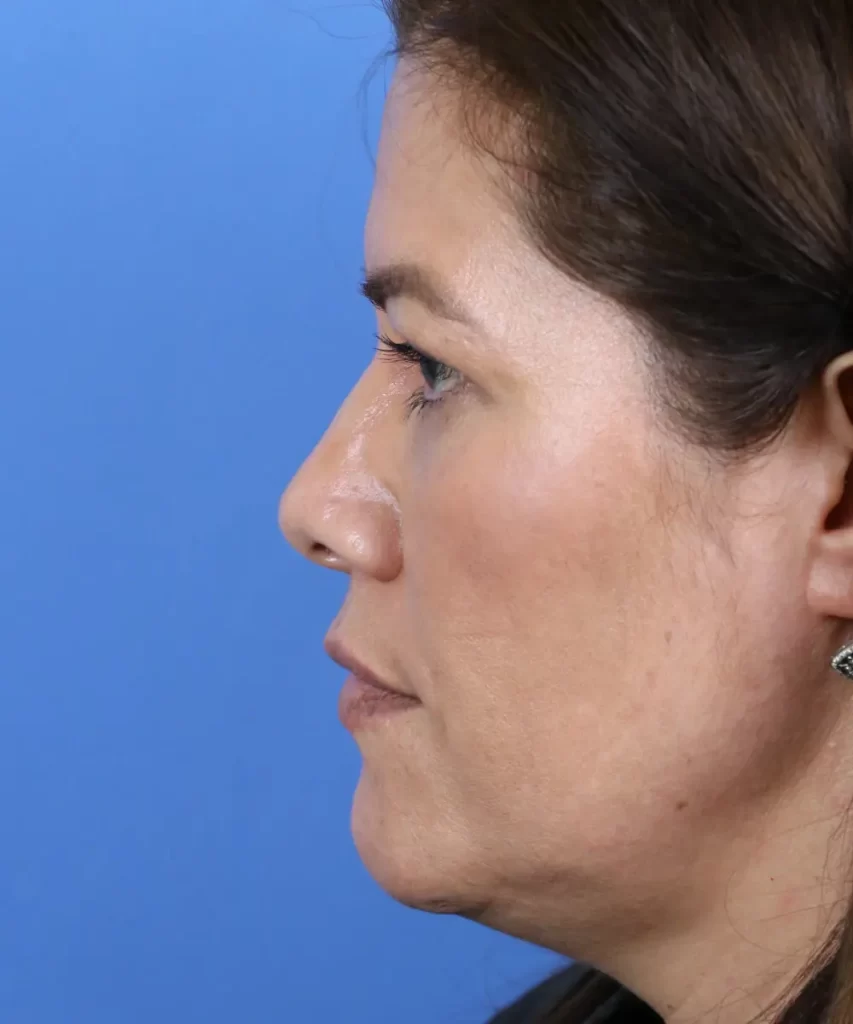 Profile view of a woman with brown hair against a blue background, showcasing facial features and ears.