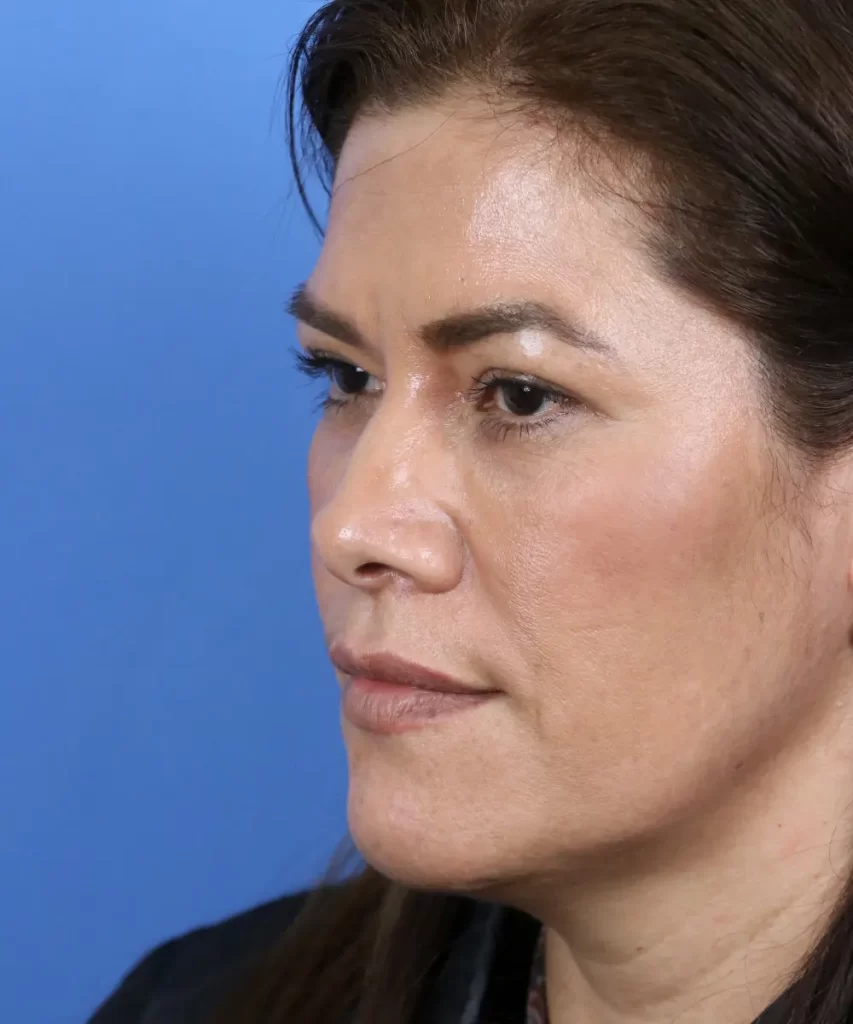 Profile of a person with brown hair and a neutral expression against a blue background.