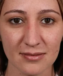 Close-up of a person's face looking directly at the camera. The individual has brown eyes, light skin, and dark hair.