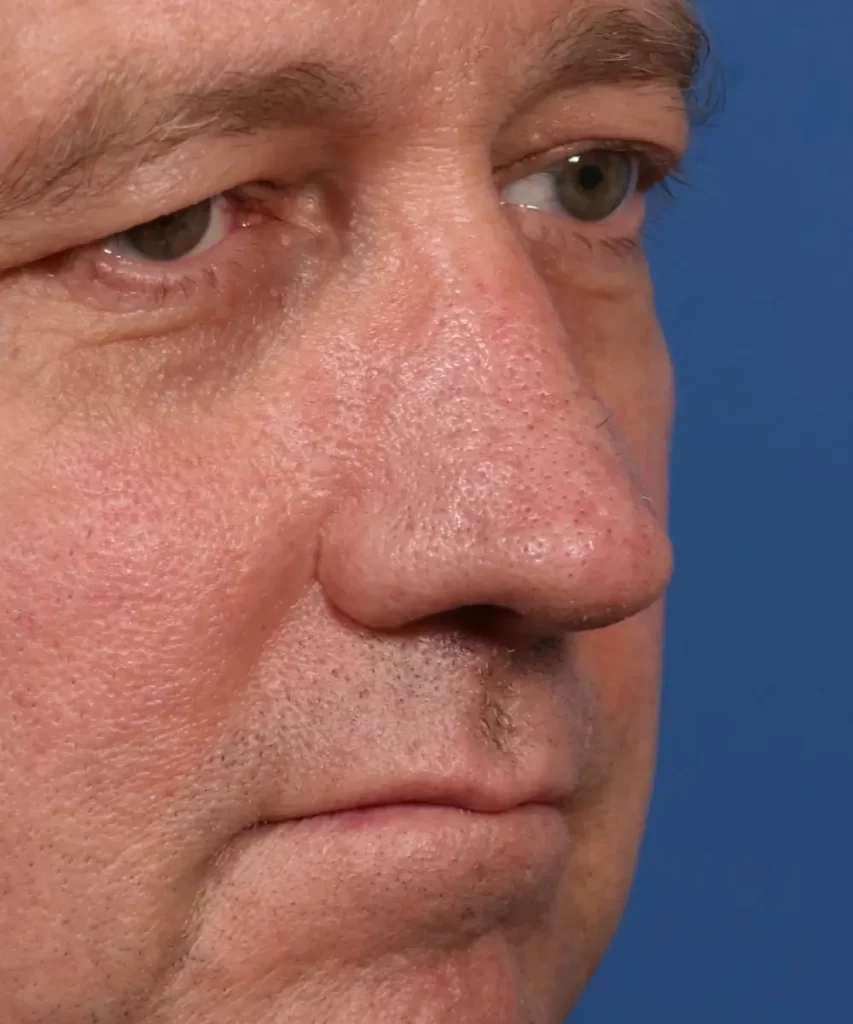 Close-up of a middle-aged man's face, showing details of his skin and eyes against a blue background.