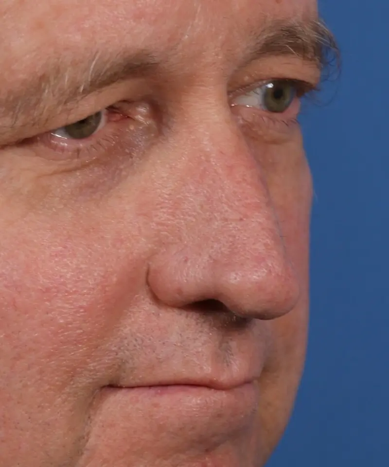 Close-up of an older man's face against a blue background, showing his green eyes and light skin, with visible facial hair and expression lines.