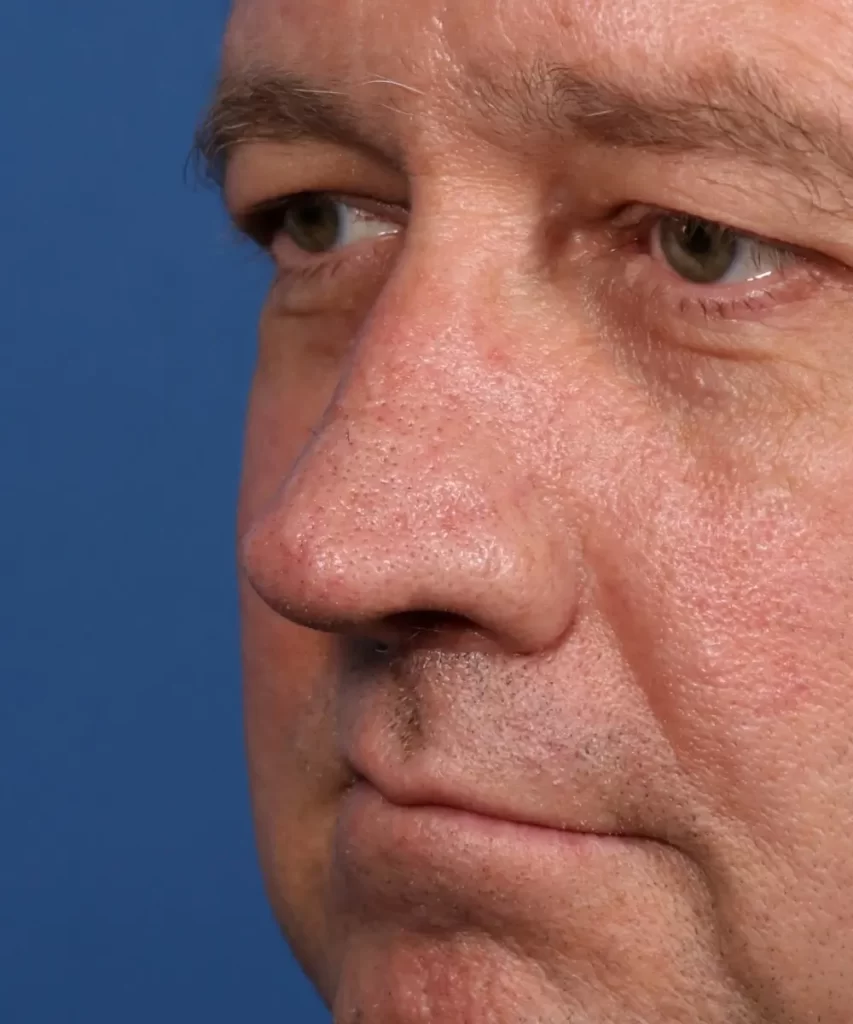 Close-up of a middle-aged man's face against a blue background, showing his eyes, nose, and part of his mouth with a neutral expression.