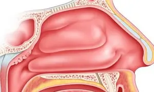 Cross-section illustration of nasal cavity anatomy showing detailed structures including nasal passages, sinuses, and surrounding bones.