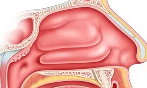 Illustration of a cross-section of human nasal cavity showing the sinuses, nasal passage, and surrounding structures.