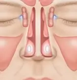 Anatomical illustration of a human face showing sinus cavities in the nasal area, highlighting air-filled spaces behind the forehead, cheeks, and eyes.