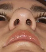Close-up view of a person's face from below, focusing on the nose and mouth.
