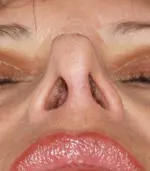 Close-up of a person's upturned nose with visible nostrils, closed eyes, and lips with lipstick.
