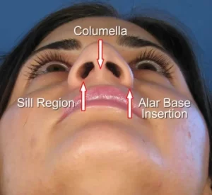 A close-up of a person's upturned head showing labeled parts of the nose: columella, sill region, and alar base insertion.