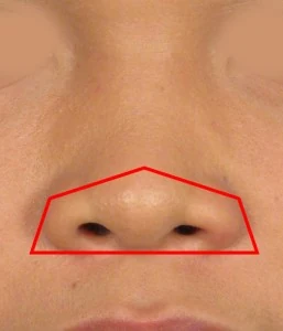 Close-up of a person's nose with a red pentagonal outline highlighting the nasal area.