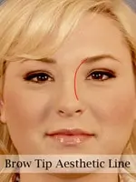 A person's face with a red line emphasizing the brow tip aesthetic line, highlighting eyebrow alignment.