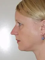 Profile of a person with short blonde hair, wearing earrings, against a plain background.