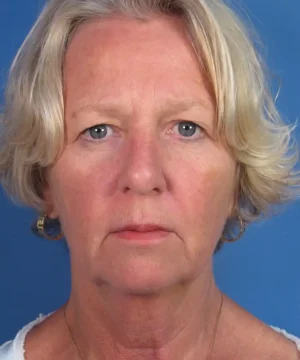 An older woman with short blonde hair looks directly at the camera against a plain blue background.