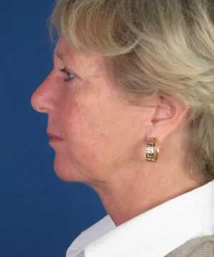 Profile view of an older woman with short, light hair against a blue background, wearing a white collared shirt and gold hoop earrings.