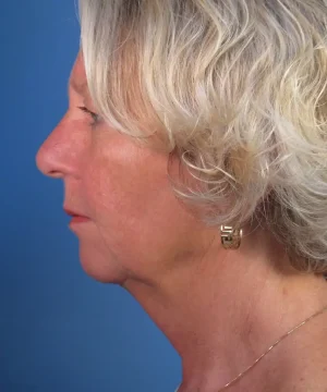 Profile view of an older person with short, wavy gray hair against a blue background, showing a neutral expression and wearing a gold earring.