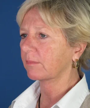 A person with short blonde hair is looking to the side against a blue background. They are wearing a white collared shirt and gold hoop earrings.