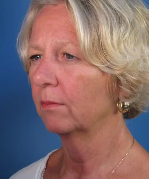 Older woman with short blonde hair looks to the side against a blue background, wearing a white top and gold earrings.