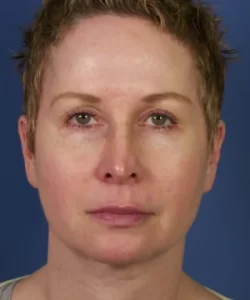 A person with short hair and a neutral expression against a blue background.