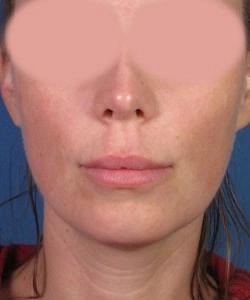 Close-up of a person's face with blurred eyes on a blue background. The person has a neutral expression and wears a red top.