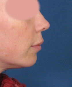 Profile view of a person's face with obscured eyes, shown against a blue background.