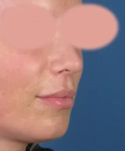 Close-up of a person's profile with blurred eyes, against a blue background.
