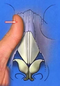 Illustration of a thumb pressing on a diagram with an arrow pointing right.