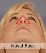 Close-up of a person looking up, showing the nasal base highlighted with a red triangle. Text reads "Nasal Base" at the bottom.