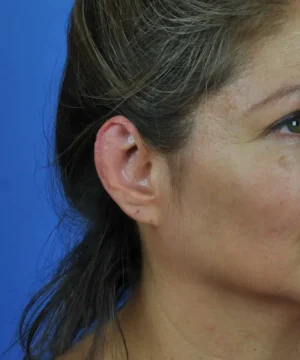 A close-up of a person's face in profile, focusing on the ear and side of the head against a blue background.