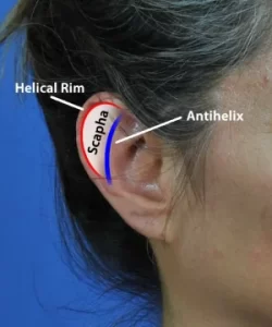 Close-up of a human ear with labeled parts: Helical Rim, Scapha, and Antihelix against a blue background.