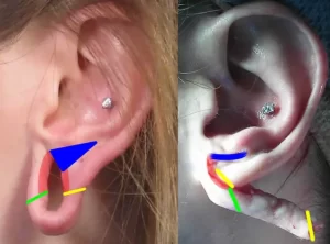 Comparison of two ears with stretched earlobes, highlighting different sections with colored lines: blue, green, yellow, and red, indicating various aspects of ear modifications.
