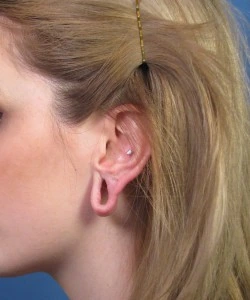 Close-up of a person's ear with stretched earlobe, wearing a small earring. Hair is pinned back with a hairpin.