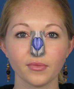 A woman with earrings has a facial painting of a detailed sinus anatomy in shades of blue and gray on her nose.