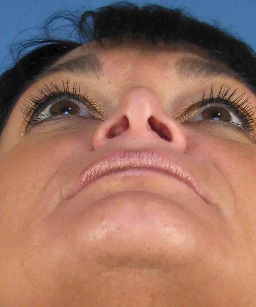 Close-up view of a person's face from below, focusing on the nose and mouth. The head is tilted back, looking upwards.
