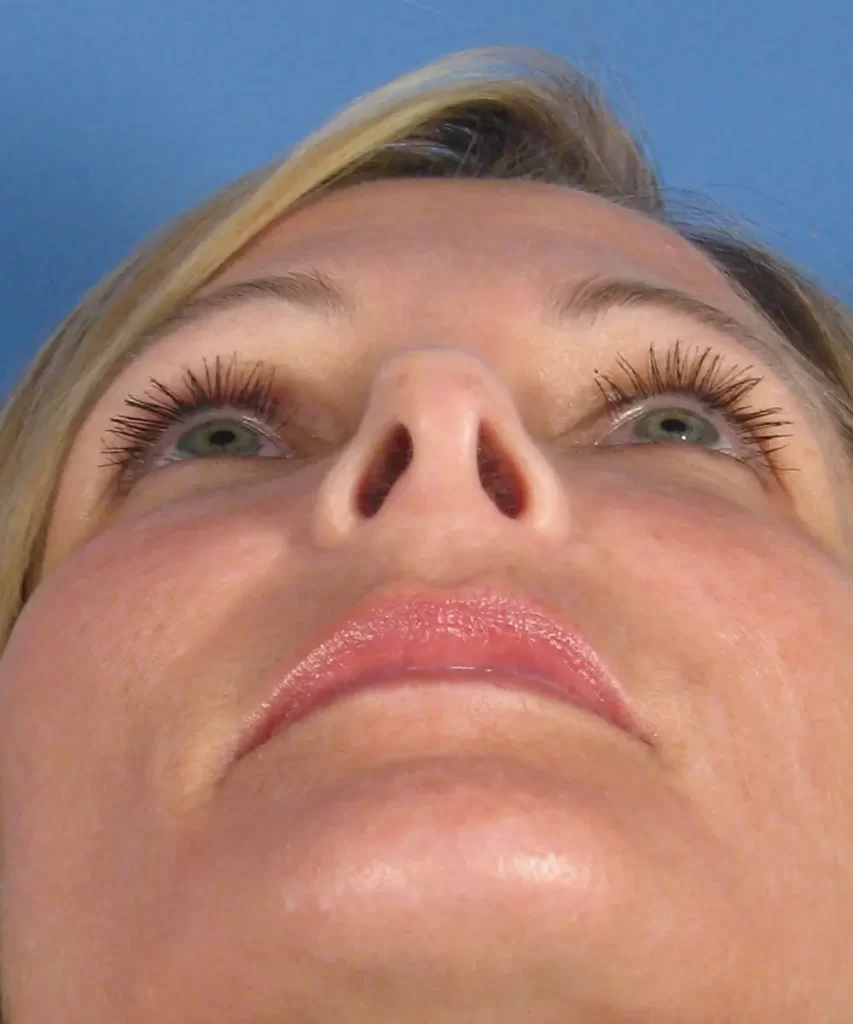 Close-up of a person looking upwards against a blue background, focusing on the nose and eyes.