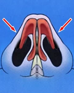 Diagram of a nasal cavity cross-section, highlighting the nasal passages in black with red arrows pointing to them.