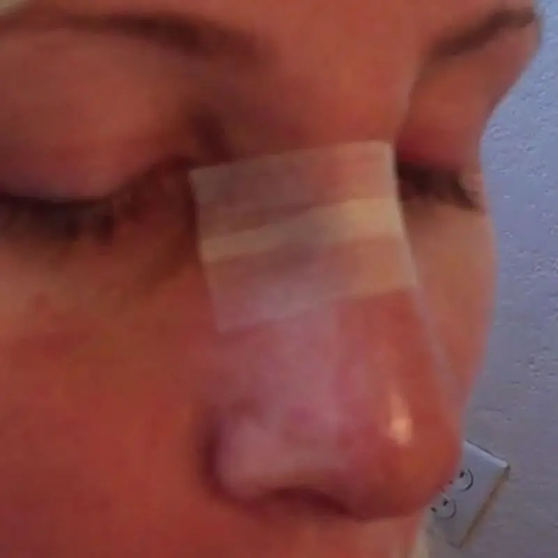 Close-up of a person's nose with a small adhesive strip across the bridge, eyes closed.