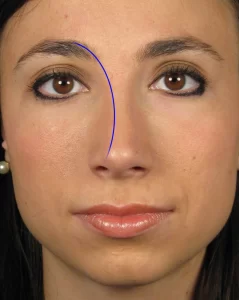 A close-up of a woman's face with a blue curved line overlaid from her left eyebrow to the right side of her nose.