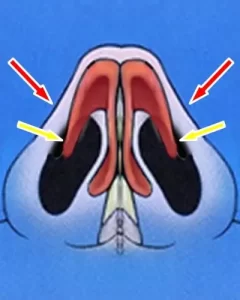 Cross-section diagram of nasal cavity with red and yellow arrows indicating different areas.